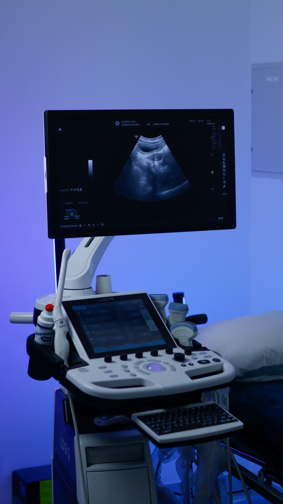 Ultrasound system with its console and an overhead monitor displaying a scan image, next to an exam bed