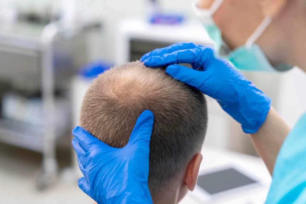 Hair Transplant Treatment